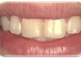 Metsger Patel Dental | Periodontal Treatment, Teeth Whitening and Dental Fillings