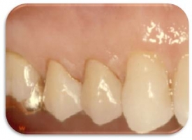 Metsger Patel Dental | Cosmetic Dentistry, Digital Impressions and All-on-4 reg