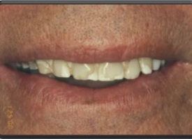 Metsger Patel Dental | Full Mouth Reconstruction, Periodontal Treatment and Preventative Program