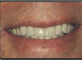 Metsger Patel Dental | Oral Cancer Screening, Periodontal Treatment and Implant Restorations