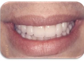 Metsger Patel Dental | Emergency Treatment, Implant Dentistry and Preventative Program