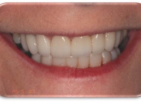 Metsger Patel Dental | Intraoral Camera, Digital Radiography and Emergency Treatment